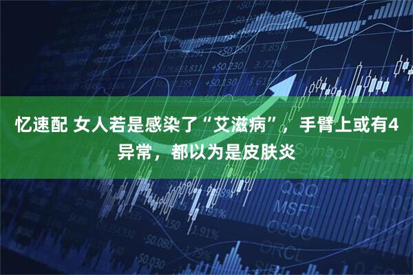忆速配 女人若是感染了“艾滋病”，手臂上或有4异常，都以为是皮肤炎